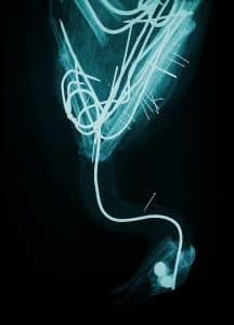 Secretarybird (X-ray), Helena Hunter, 2019