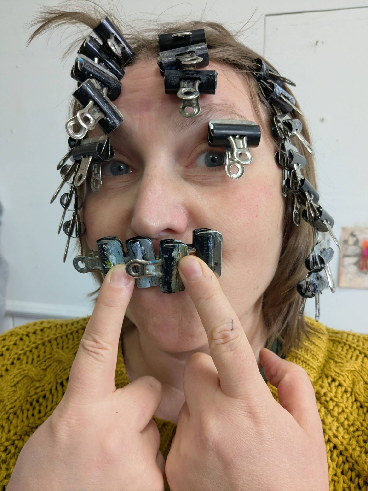 A woman with metal clips on her face. Photograph