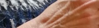 section of  fairsile jumper and veins on a hand