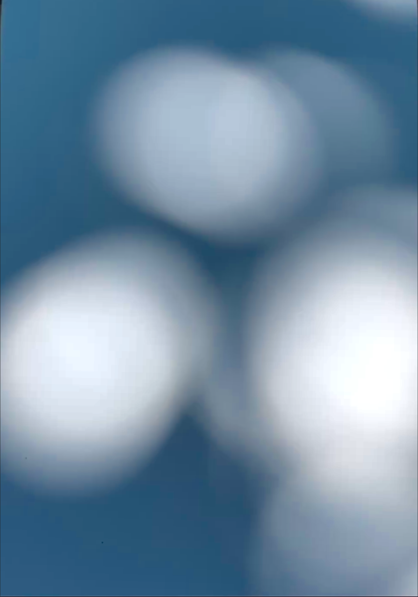 pale egg shaped volumes appearing through the trees under strong sunlight