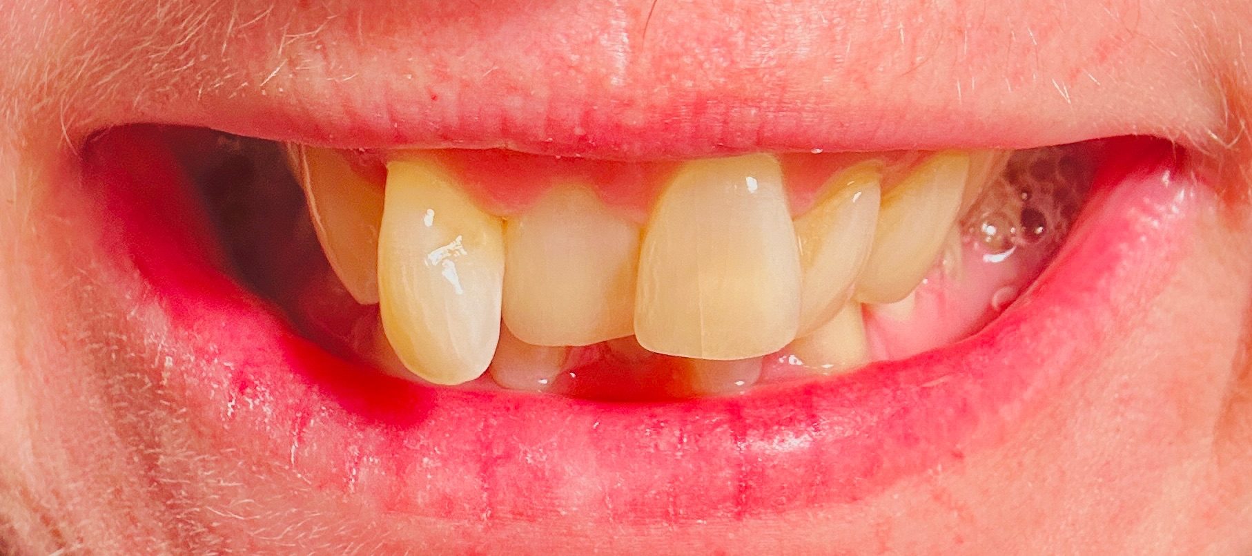 Close up of a smiling mouth with wonky teeth