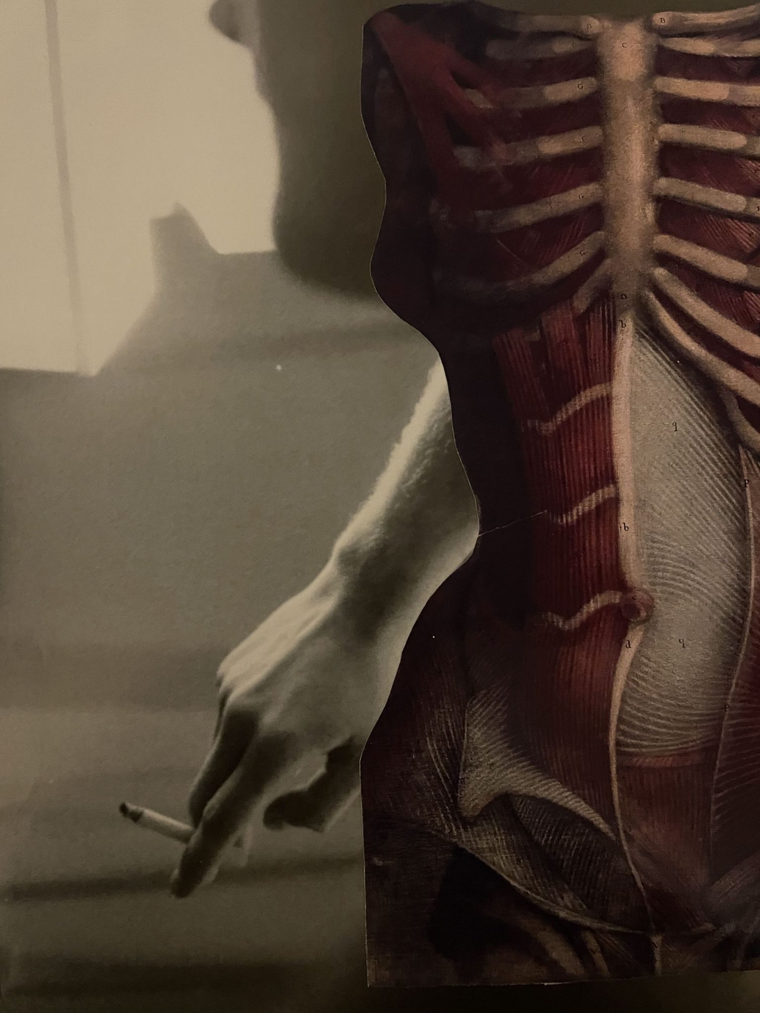 A moody, surreal collage shows a shadowy figure smoking, sliced alongside a detailed anatomical illustration of the human torso and muscles, blending flesh, anatomy, and silhouette into a single haunting image.
