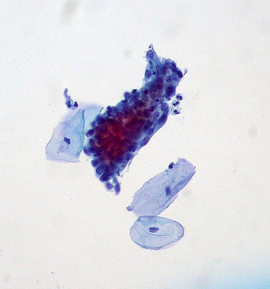 Microscopic cell scan. Blue purple pink looks like a cluster of grapes.