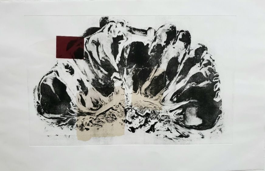 Aquatint etching of a diseased kidney