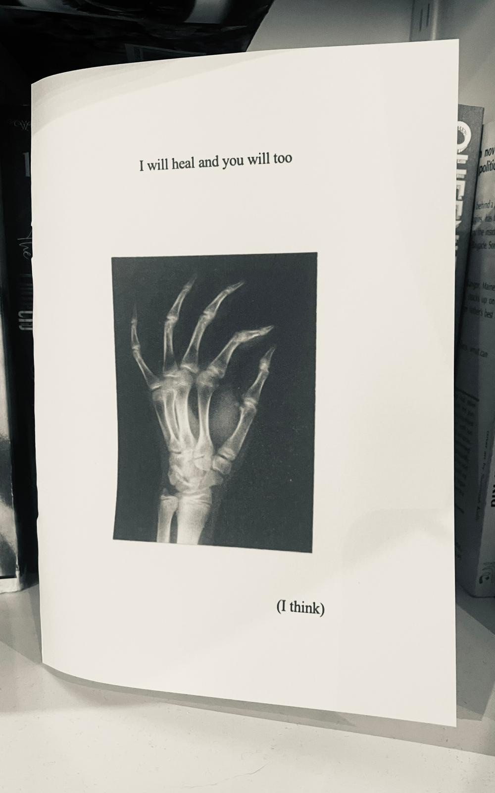 Black and white photo of paper on a shelf - text reads “I will heal and you will too (I think) with an image of an x-ray hand.